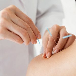 Massage DIP (Stimulation des points d'Acupuncture) 15 min.