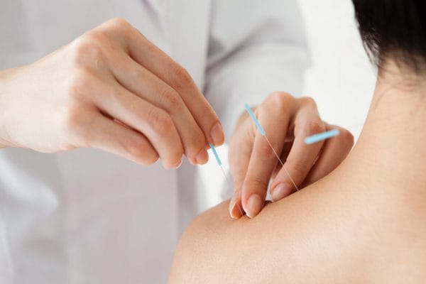 Massage DIP (Stimulation des points d'Acupuncture) 15 min.