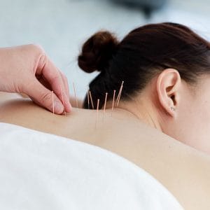 Massage DIP (Stimulation des points d'Acupuncture) 30 min.